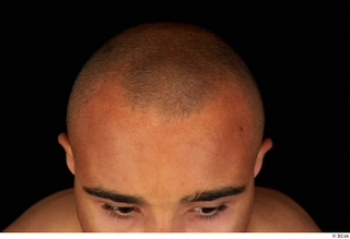 Aaron bald hair 0001.jpg